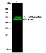 KYNU Antibody in Immunoprecipitation (IP)