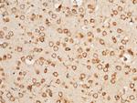 RAP Antibody in Immunohistochemistry (Paraffin) (IHC (P))