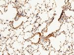 RAP Antibody in Immunohistochemistry (Paraffin) (IHC (P))