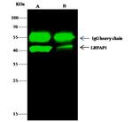 RAP Antibody in Immunoprecipitation (IP)