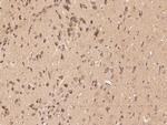 PCSK9 Antibody in Immunohistochemistry (Paraffin) (IHC (P))