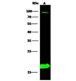 PPBP Antibody in Western Blot (WB)