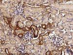 TROP2 Antibody in Immunohistochemistry (Paraffin) (IHC (P))