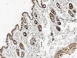 TROP2 Antibody in Immunohistochemistry (Paraffin) (IHC (P))