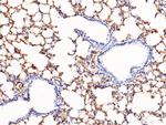 Vitronectin Antibody in Immunohistochemistry (Paraffin) (IHC (P))