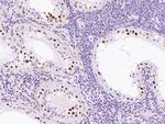 HP1 beta Antibody in Immunohistochemistry (Paraffin) (IHC (P))