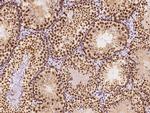 HP1 beta Antibody in Immunohistochemistry (Paraffin) (IHC (P))