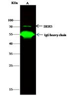 DDX5 Antibody in Immunoprecipitation (IP)