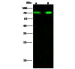 DDX5 Antibody in Western Blot (WB)