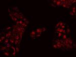 FOXP2 Antibody in Immunocytochemistry (ICC/IF)