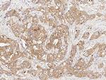 GDI1 Antibody in Immunohistochemistry (Paraffin) (IHC (P))