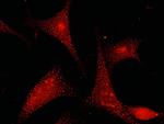 GSTP1 Antibody in Immunocytochemistry (ICC/IF)