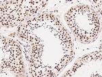 HDAC1 Antibody in Immunohistochemistry (Paraffin) (IHC (P))