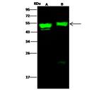 Cytokeratin 17 Antibody in Western Blot (WB)