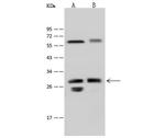 LIN7A Antibody in Western Blot (WB)