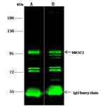 NR3C2 Antibody in Immunoprecipitation (IP)