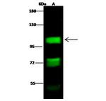 NR3C2 Antibody in Western Blot (WB)