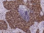 RbAp48 Antibody in Immunohistochemistry (Paraffin) (IHC (P))