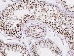 RbAp48 Antibody in Immunohistochemistry (Paraffin) (IHC (P))