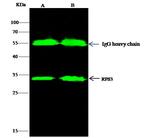 RPS3 Antibody in Immunoprecipitation (IP)