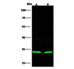 RPS3 Antibody in Western Blot (WB)