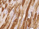 Cardiac Troponin C Antibody in Immunohistochemistry (Paraffin) (IHC (P))