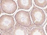 CHCHD4 Antibody in Immunohistochemistry (Paraffin) (IHC (P))