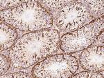 CHCHD4 Antibody in Immunohistochemistry (Paraffin) (IHC (P))