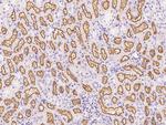 EphB2 Antibody in Immunohistochemistry (Paraffin) (IHC (P))