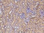 CD171 Antibody in Immunohistochemistry (Paraffin) (IHC (P))