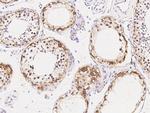 CD30 Antibody in Immunohistochemistry (Paraffin) (IHC (P))