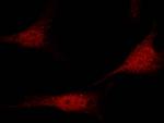 PRMT1 Antibody in Immunocytochemistry (ICC/IF)