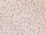 PRMT1 Antibody in Immunohistochemistry (Paraffin) (IHC (P))