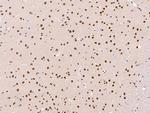 PRMT1 Antibody in Immunohistochemistry (Paraffin) (IHC (P))