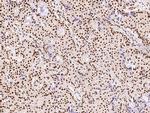 PRMT1 Antibody in Immunohistochemistry (Paraffin) (IHC (P))