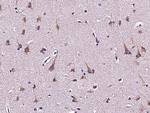 PDGFRB Antibody in Immunohistochemistry (Paraffin) (IHC (P))