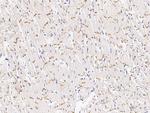 Desmocollin 2 Antibody in Immunohistochemistry (Paraffin) (IHC (P))