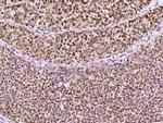 PCNA Antibody in Immunohistochemistry (Paraffin) (IHC (P))