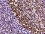 PCNA Antibody in Immunohistochemistry (Paraffin) (IHC (P))