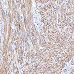 TPM1 Antibody in Immunohistochemistry (Paraffin) (IHC (P))