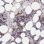 CD204 Antibody in Immunohistochemistry (Paraffin) (IHC (P))