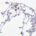 CD204 Antibody in Immunohistochemistry (Paraffin) (IHC (P))