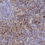 CD204 Antibody in Immunohistochemistry (Paraffin) (IHC (P))