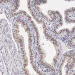 UBE1 Antibody in Immunohistochemistry (Paraffin) (IHC (P))