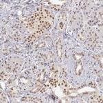 UBE1 Antibody in Immunohistochemistry (Paraffin) (IHC (P))