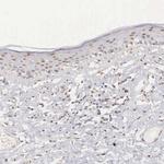 UBE1 Antibody in Immunohistochemistry (Paraffin) (IHC (P))