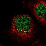 IL13RA1 Antibody in Immunocytochemistry (ICC/IF)