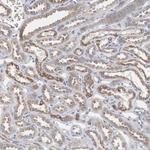 CTAGE5 Antibody in Immunohistochemistry (Paraffin) (IHC (P))