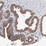 CTAGE5 Antibody in Immunohistochemistry (Paraffin) (IHC (P))