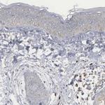 CTAGE5 Antibody in Immunohistochemistry (Paraffin) (IHC (P))